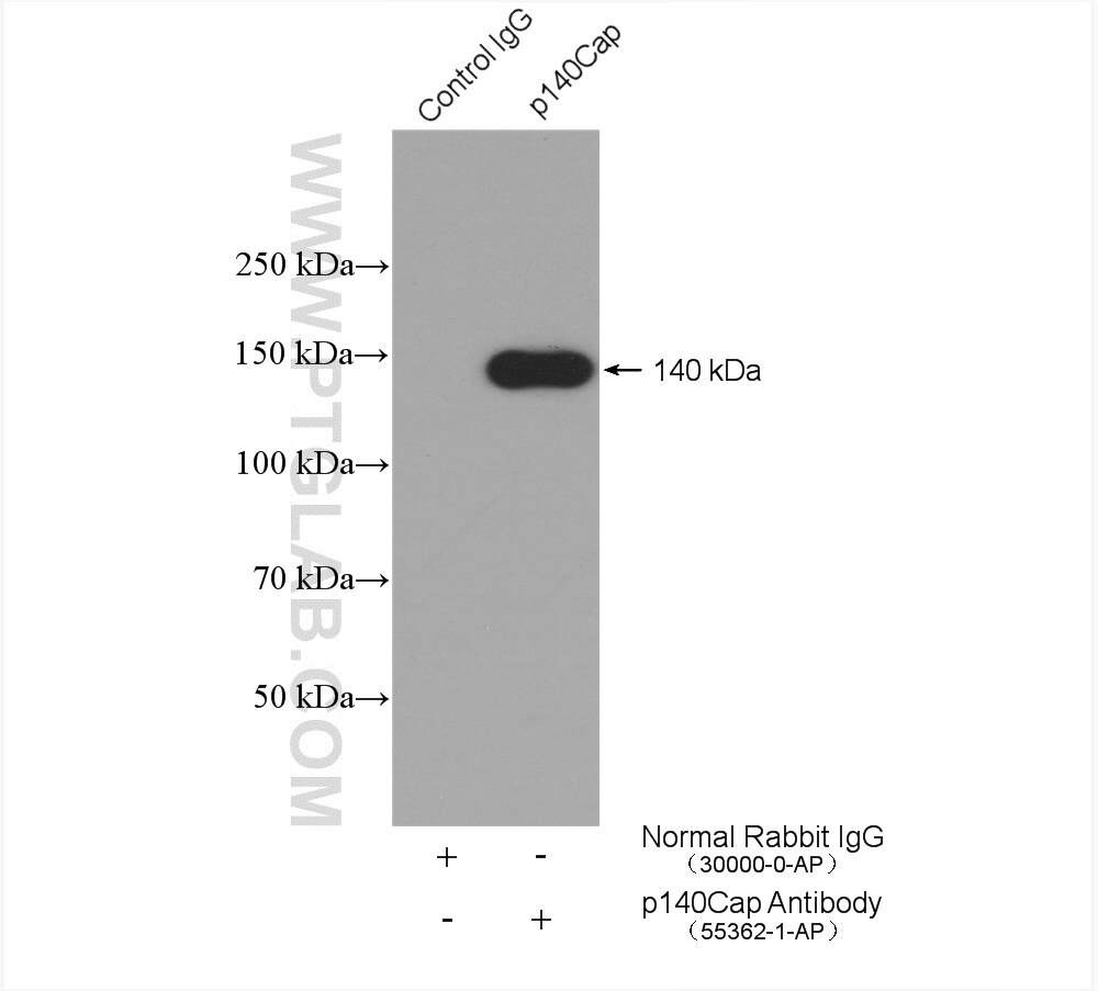 Immunoprecipitation (IP) experiment of mouse brain tissue using SNIP/p140Cap Polyclonal antibody (55362-1-AP)