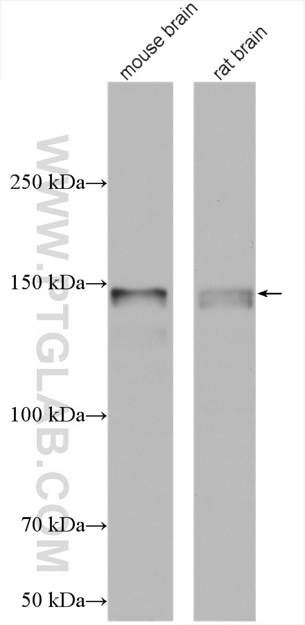 Western Blot (WB) analysis of various lysates using SNIP/p140Cap Polyclonal antibody (55362-1-AP)