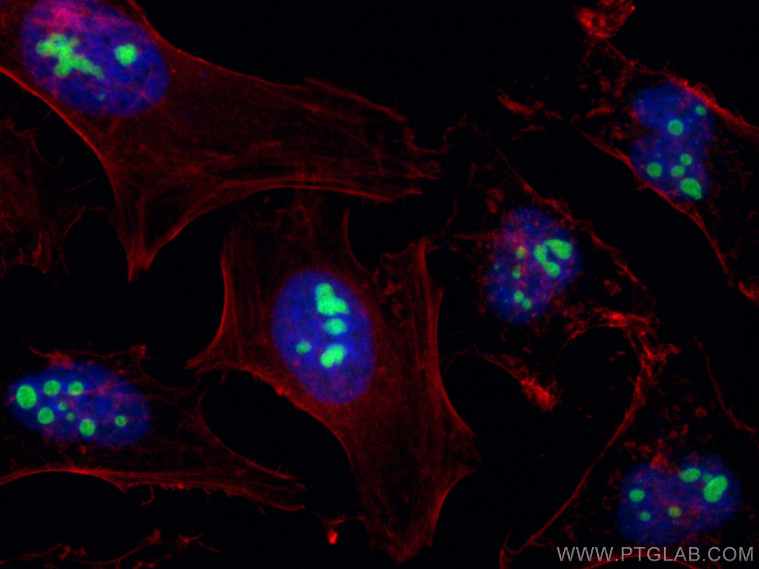 Immunofluorescence (IF) / fluorescent staining of HeLa cells using P14-ARF Polyclonal antibody (31221-1-AP)