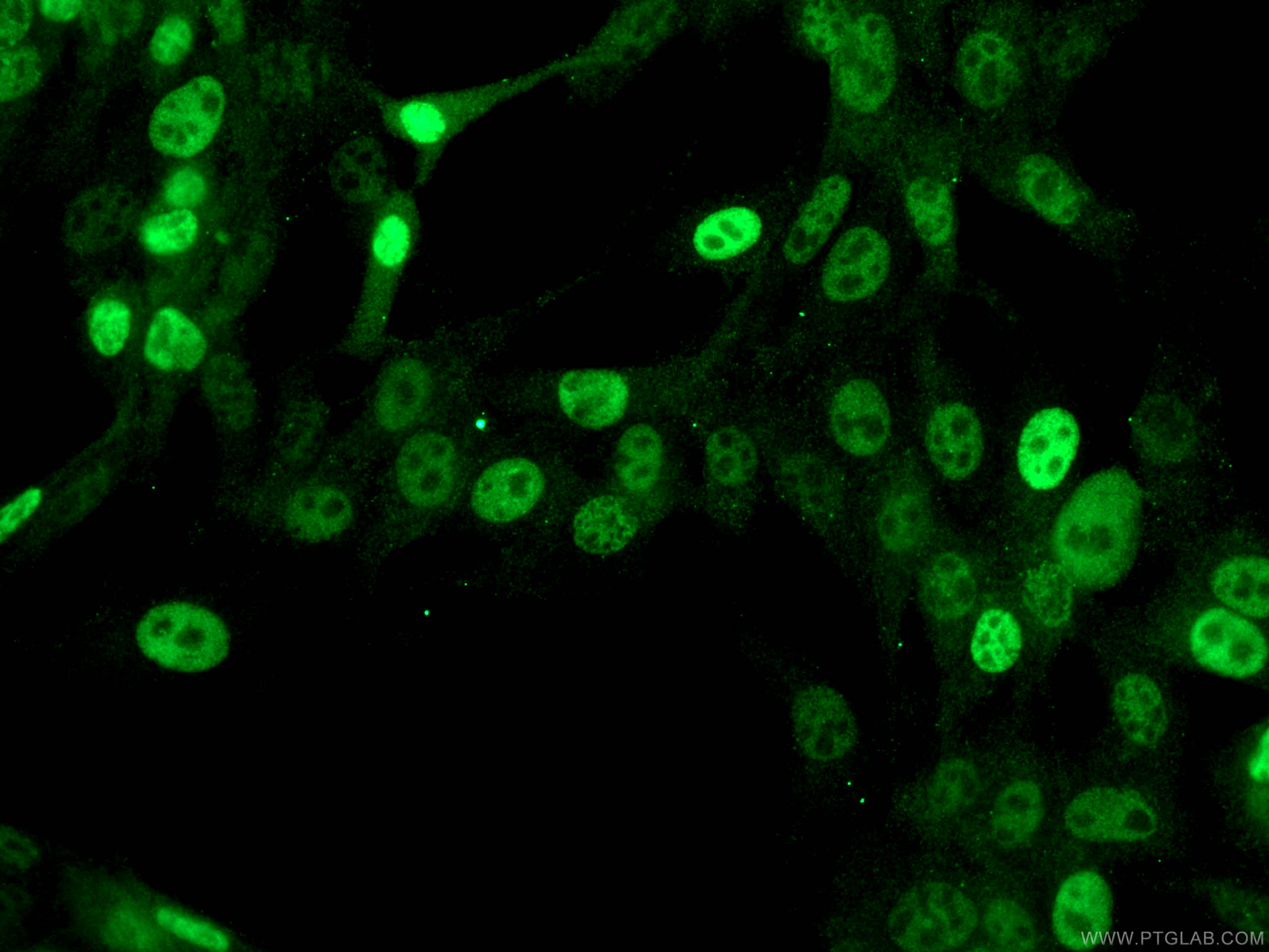 Immunofluorescence (IF) / fluorescent staining of NIH/3T3 cells using p21 Monoclonal antibody (67362-1-Ig)