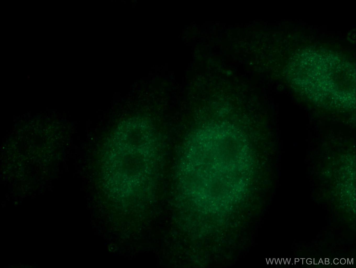 Immunofluorescence (IF) / fluorescent staining of HepG2 cells using p38 MAPK Polyclonal antibody (14064-1-AP)