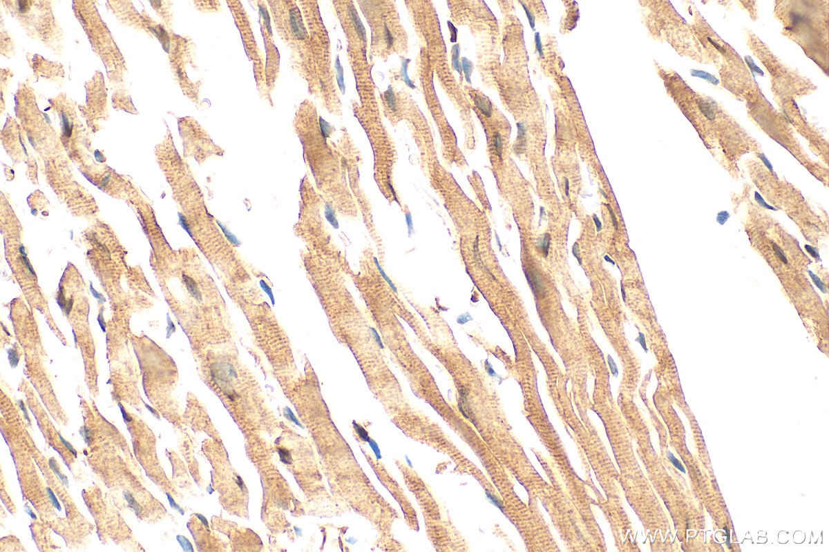 Immunohistochemistry (IHC) staining of mouse heart tissue using p38 MAPK Polyclonal antibody (14064-1-AP)