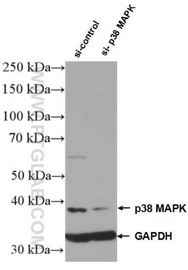 Western Blot (WB) analysis of Jurkat cells using p38 MAPK Polyclonal antibody (14064-1-AP)