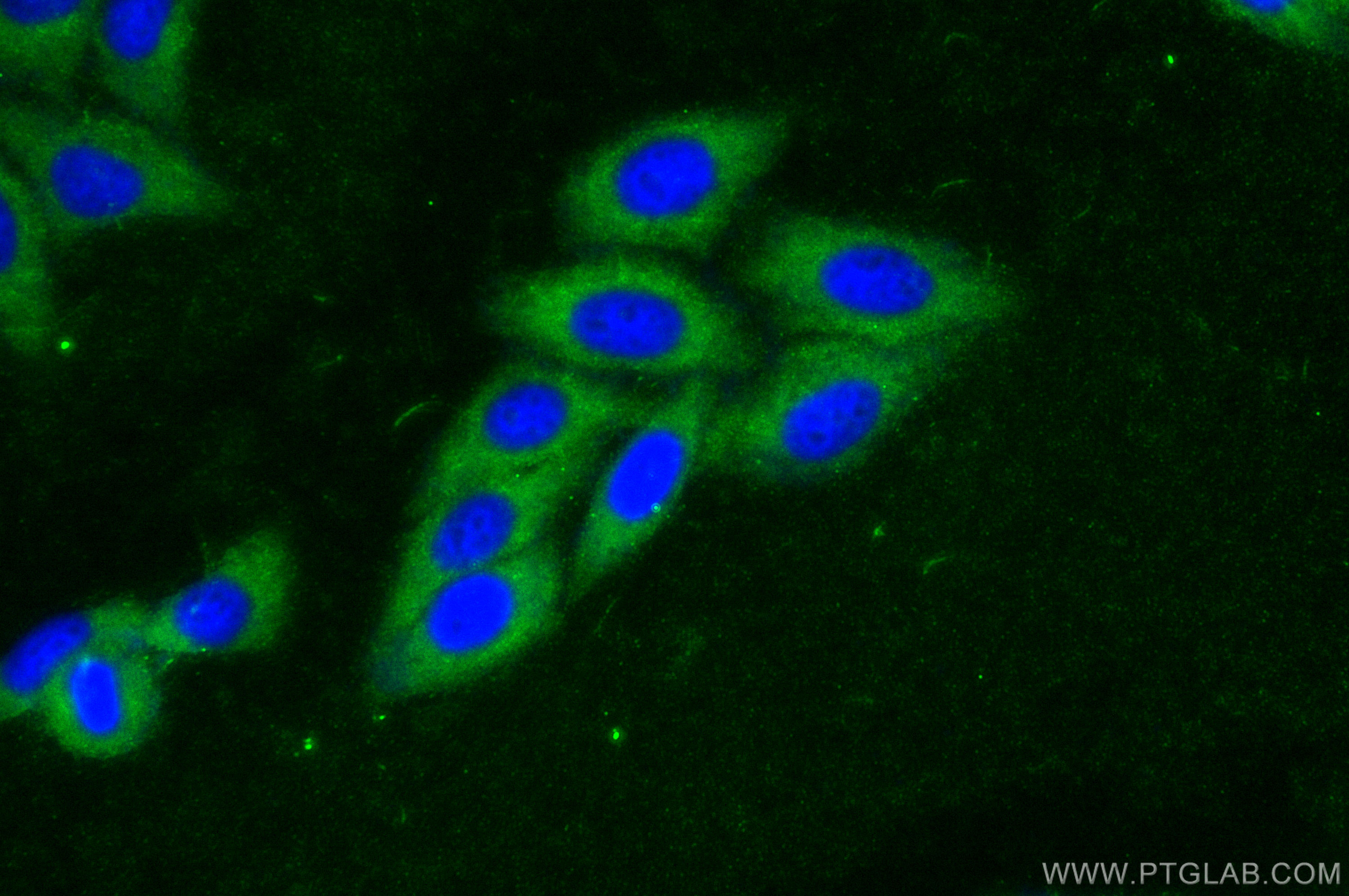 Immunofluorescence (IF) / fluorescent staining of HepG2 cells using p38 MAPK Polyclonal antibody (30382-1-AP)
