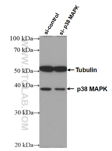 Western Blot (WB) analysis of HEK-293 cells using p38 MAPK Monoclonal antibody (66234-1-Ig)