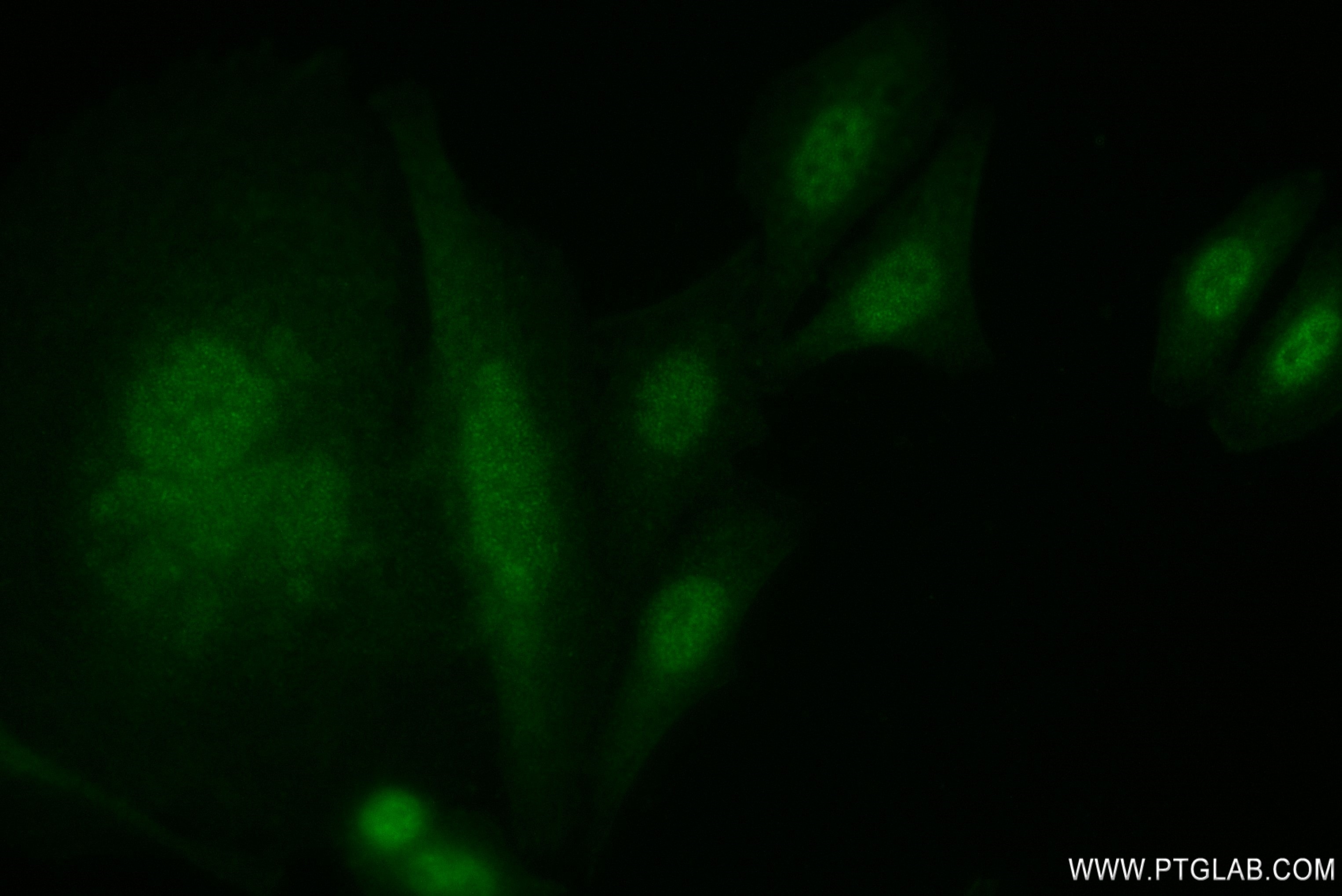 IF Staining of HepG2 using 80821-2-RR