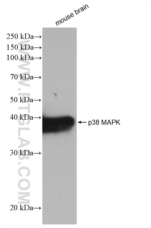 WB analysis of mouse brain using 80821-3-RR