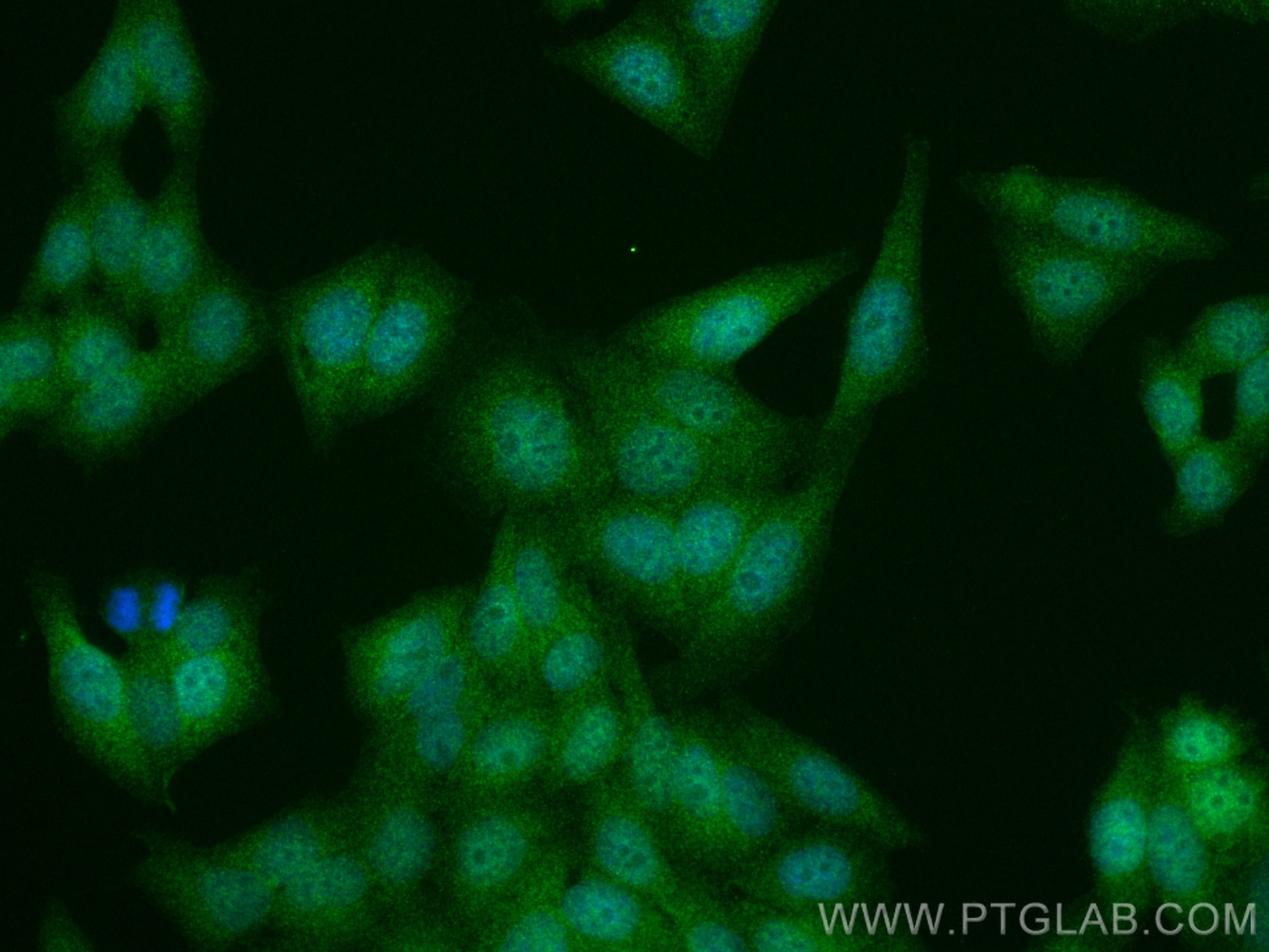 Immunofluorescence (IF) / fluorescent staining of HepG2 cells using Multi-rAb™ p38 MAPK Multi-Recombinant antibody (RMX00006)