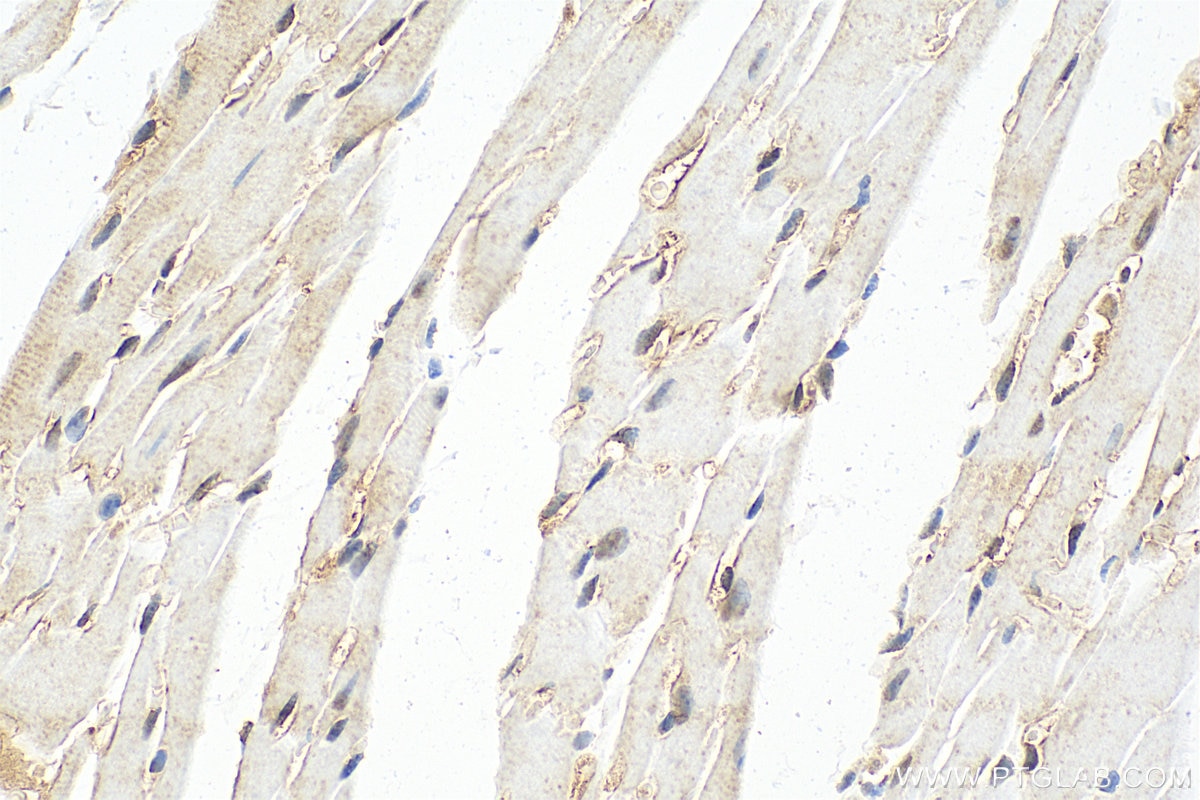 Immunohistochemistry (IHC) staining of mouse heart tissue using Multi-rAb™ p38 MAPK Multi-Recombinant antibody (RMX00006)