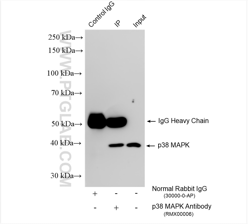 Immunoprecipitation (IP) experiment of HEK-293 cells using Multi-rAb™ p38 MAPK Multi-Recombinant antibody (RMX00006)