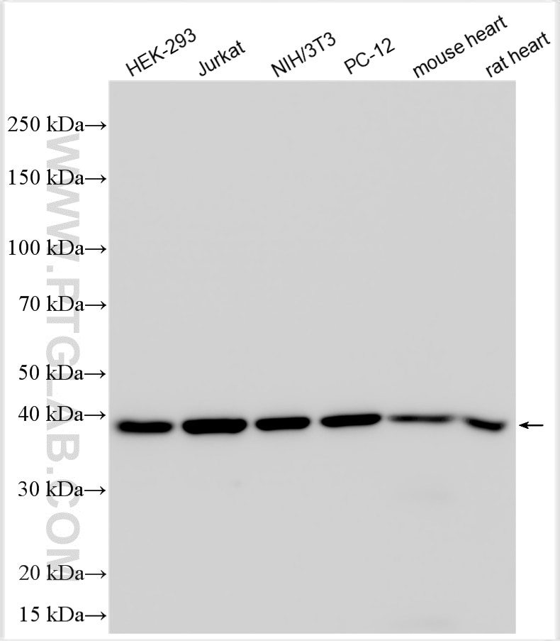 Western Blot (WB) analysis of various lysates using Multi-rAb™ p38 MAPK Multi-Recombinant antibody (RMX00006)