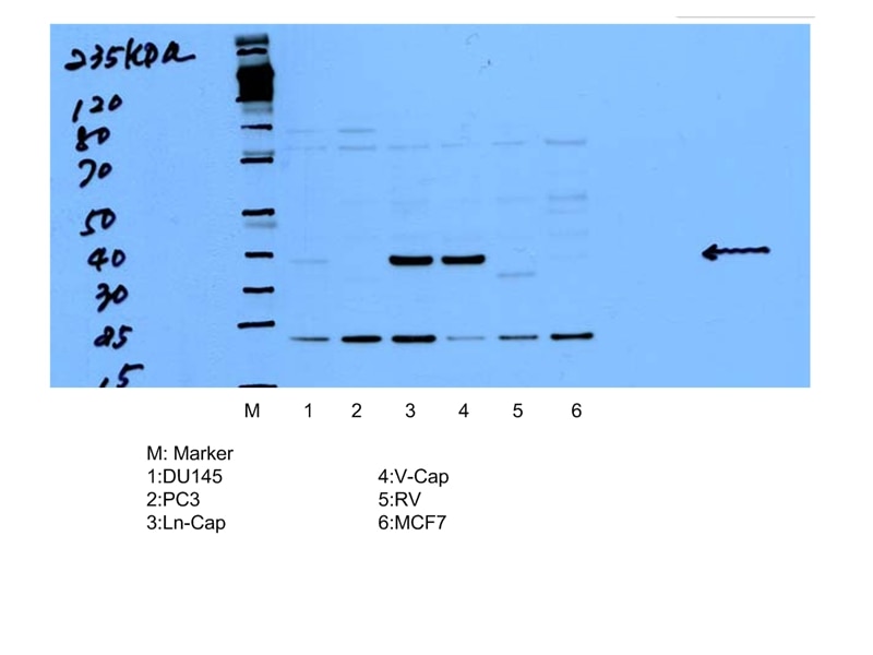 Western Blot (WB) analysis of multi-cells using AMACR/p504S Polyclonal antibody (15918-1-AP)