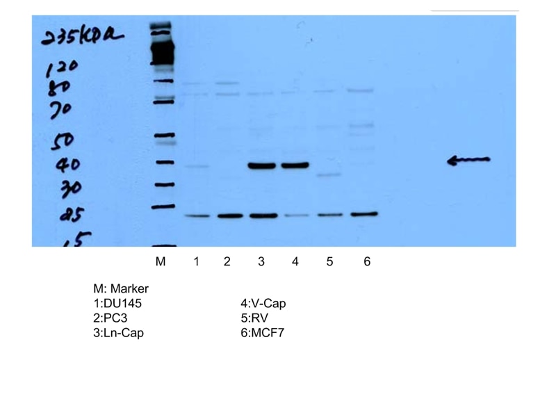 WB analysis of multi-cells using 15918-1-AP