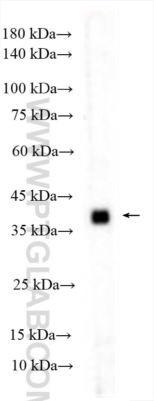 Western Blot (WB) analysis of LNCaP cells using AMACR/p504S Polyclonal antibody (15918-1-AP)