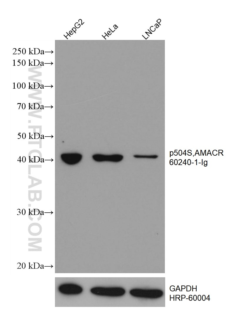 Western Blot (WB) analysis of various lysates using p504S,AMACR Monoclonal antibody (60240-1-Ig)