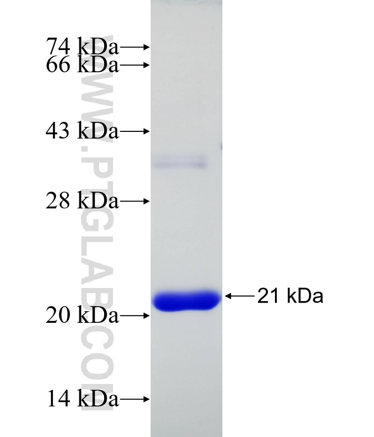 p504S,AMACR fusion protein Ag20778 SDS-PAGE
