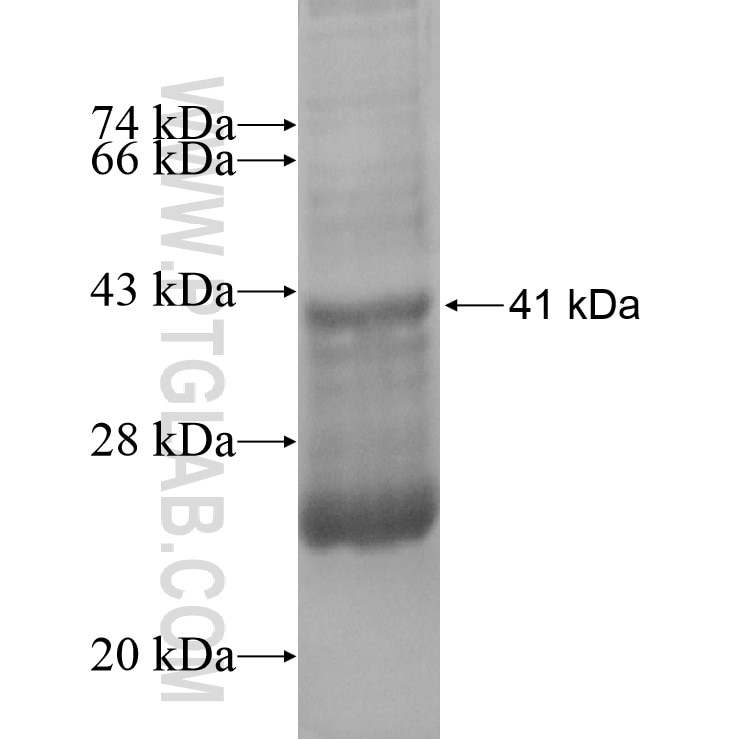 p504S,AMACR fusion protein Ag8720 SDS-PAGE