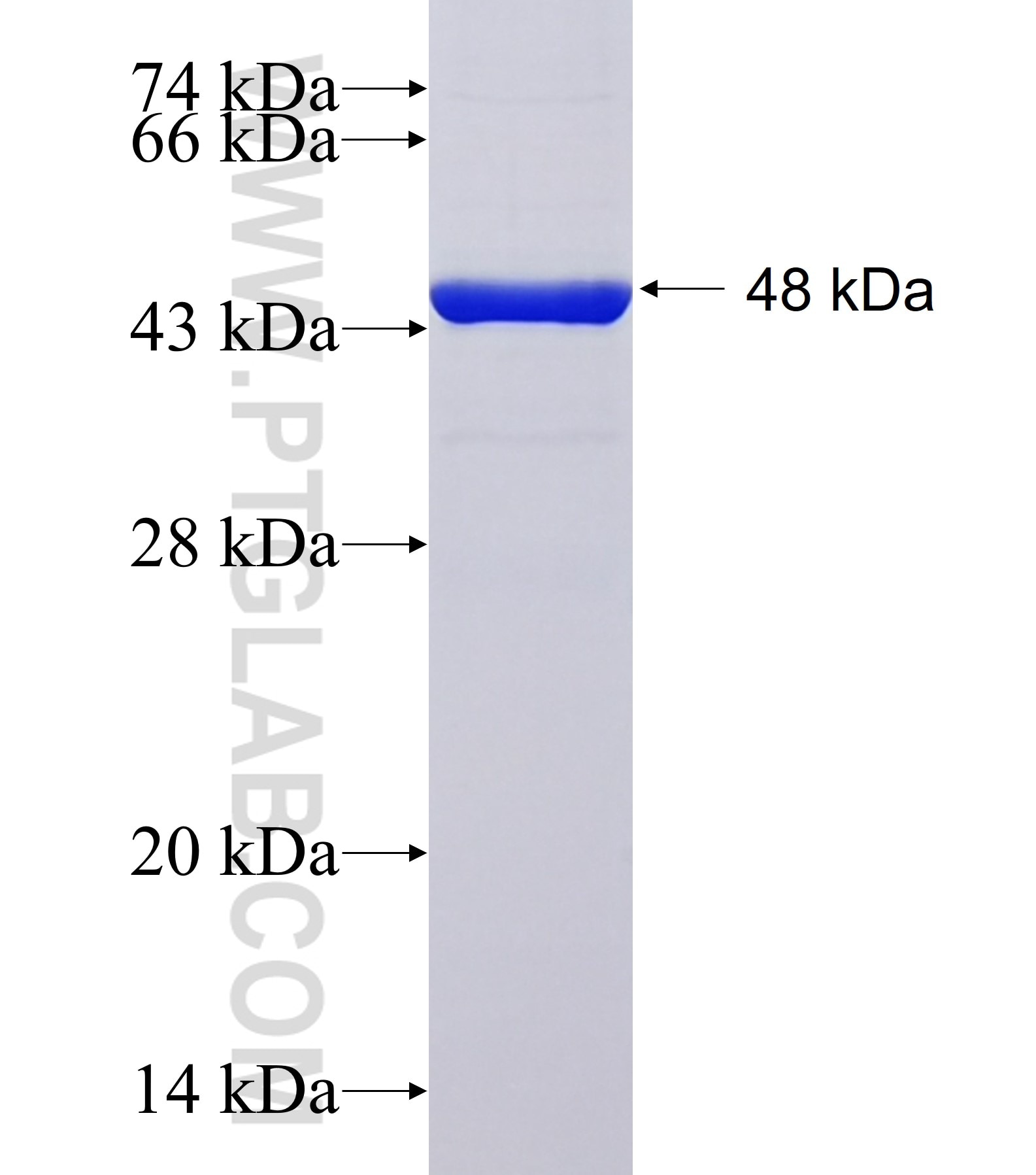 p53 fusion protein Ag41739 SDS-PAGE p53 fusion protein Ag41739 SDS-PAGE