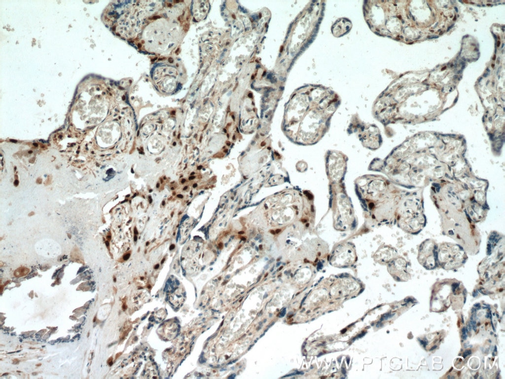 Immunohistochemistry (IHC) staining of human placenta tissue using p57Kip2 Polyclonal antibody (23317-1-AP)