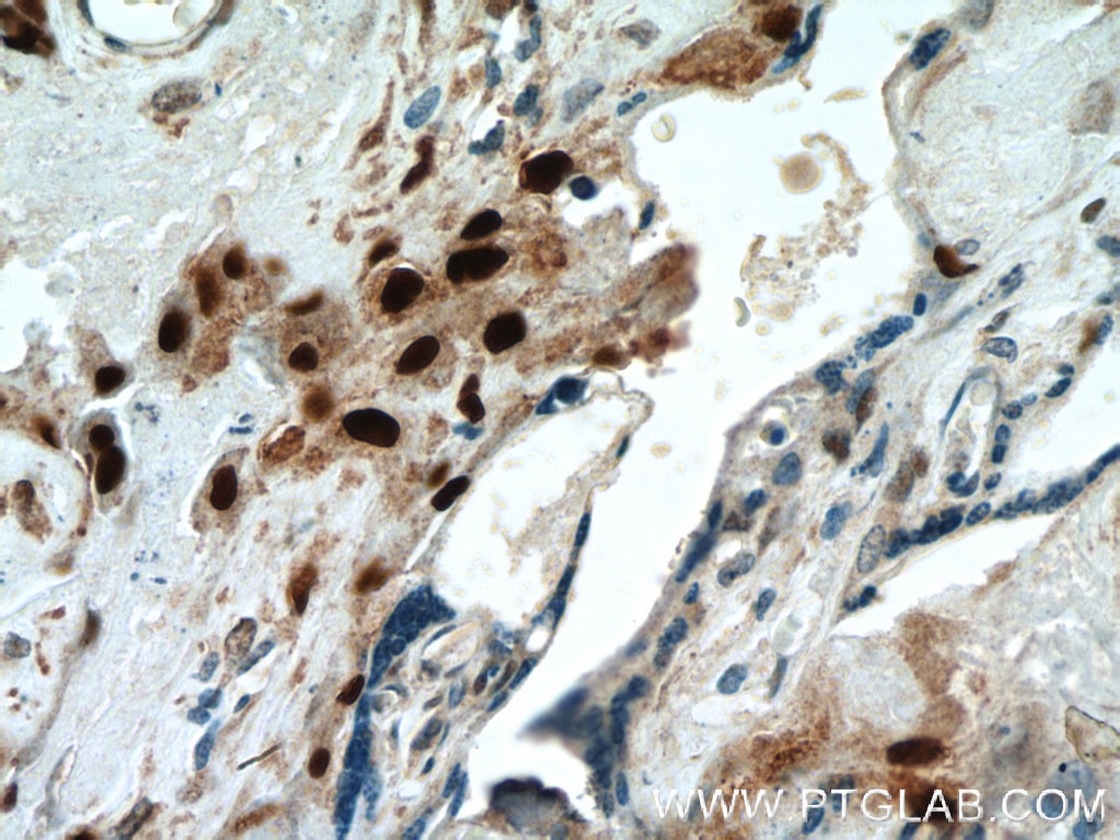 IHC staining of human placenta using 23317-1-AP