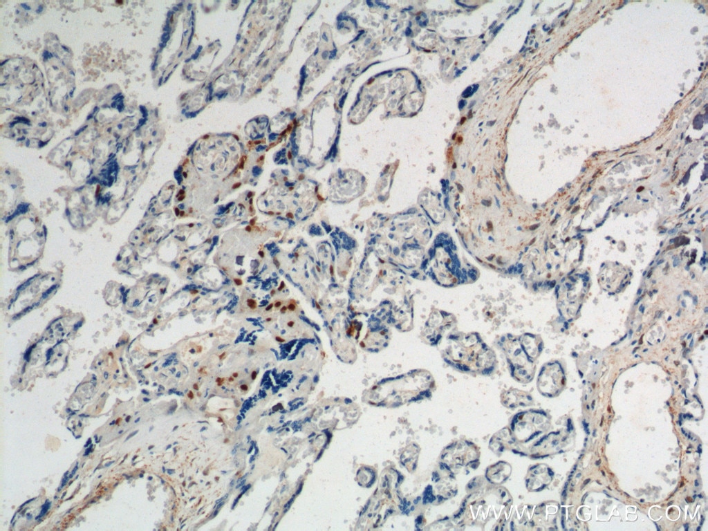 Immunohistochemistry (IHC) staining of human placenta tissue using p57Kip2 Polyclonal antibody (23317-1-AP)