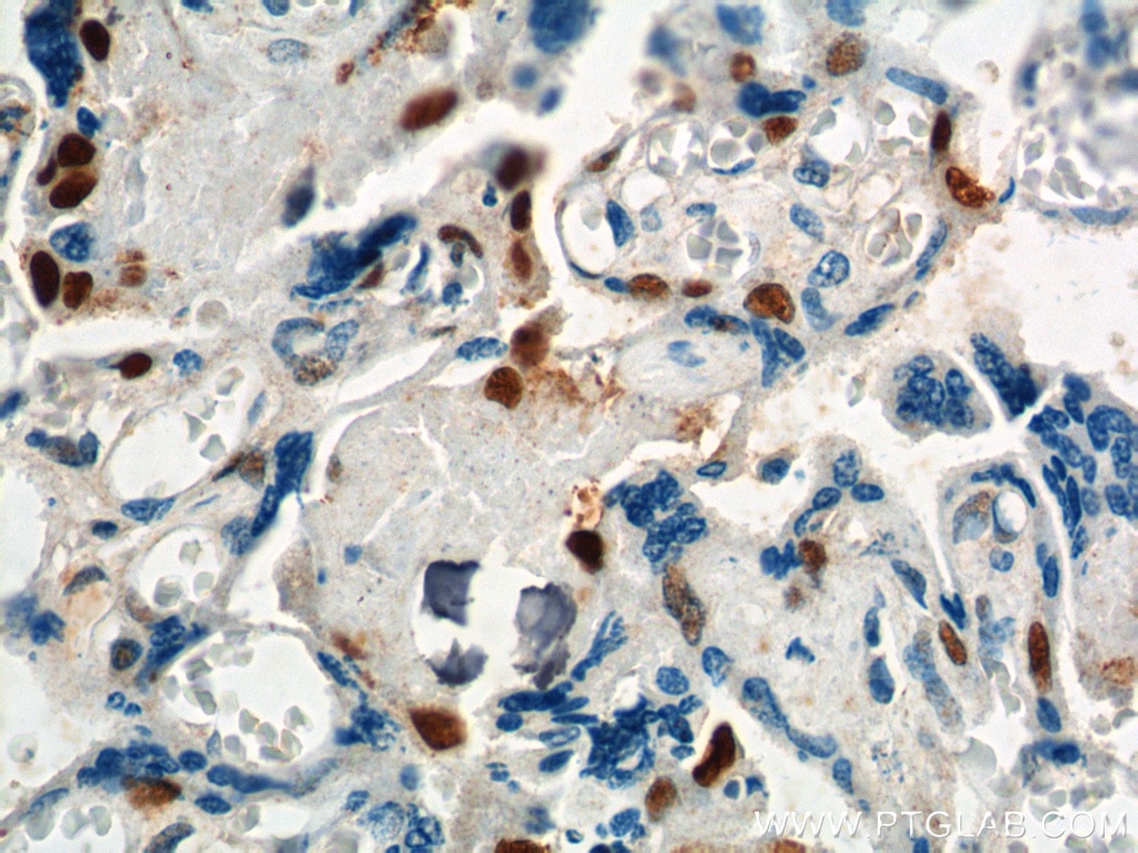 Immunohistochemistry (IHC) staining of human placenta tissue using p57Kip2 Polyclonal antibody (23317-1-AP)