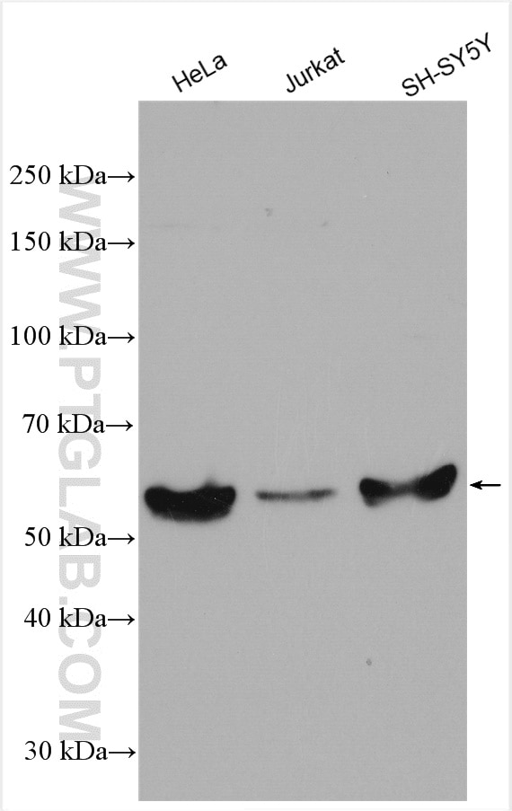 Western Blot (WB) analysis of various lysates using p57Kip2 Polyclonal antibody (23317-1-AP)