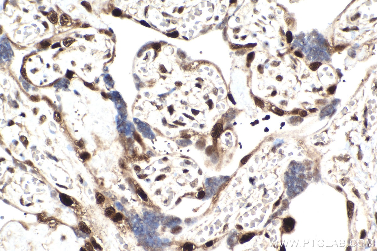 Immunohistochemistry (IHC) staining of human placenta tissue using p57Kip2 Monoclonal antibody (66794-1-Ig)