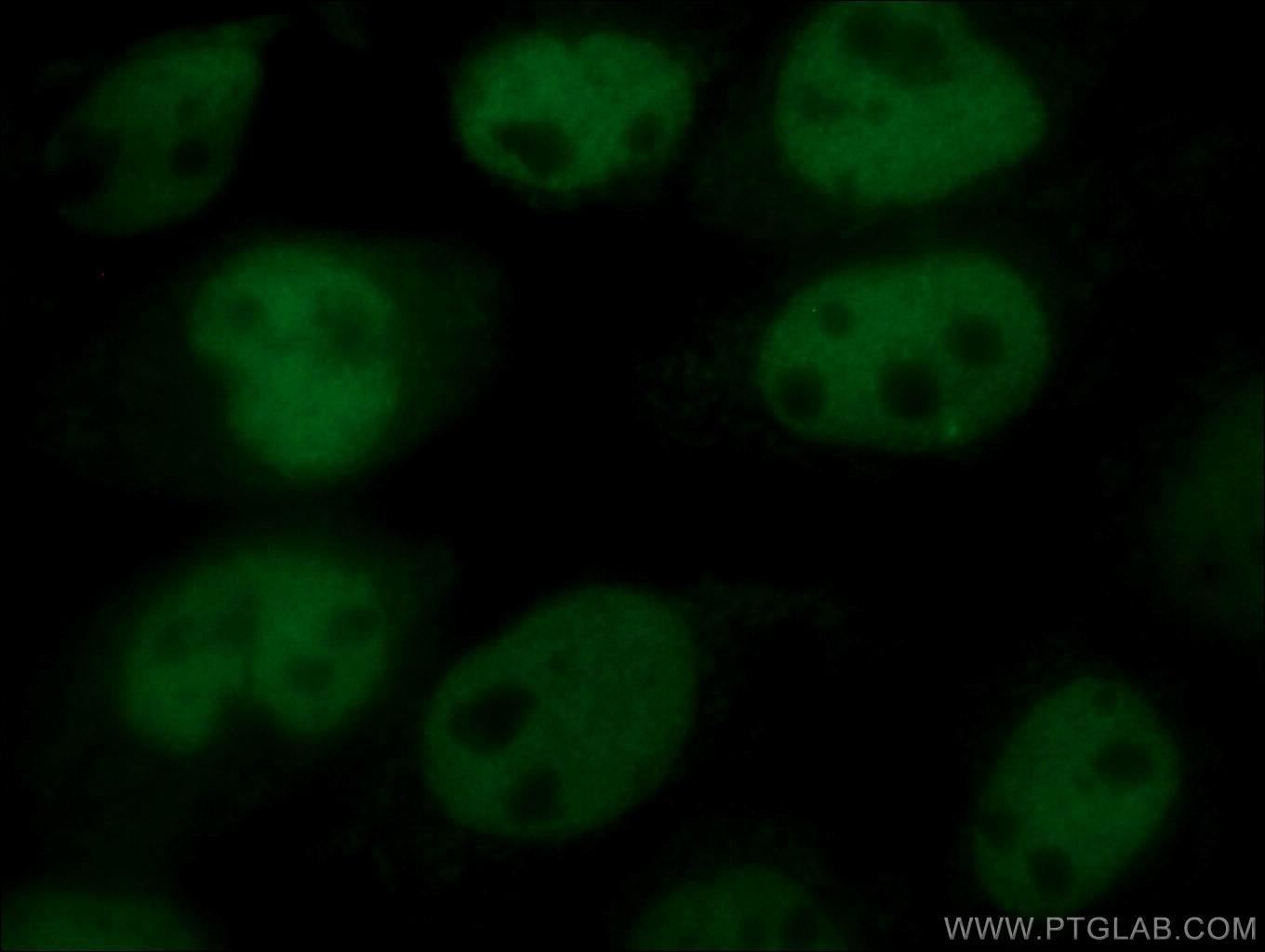 Immunofluorescence (IF) / fluorescent staining of A431 cells using CoraLite® Plus 488-conjugated p63 Polyclonal antib (CL488-12143)