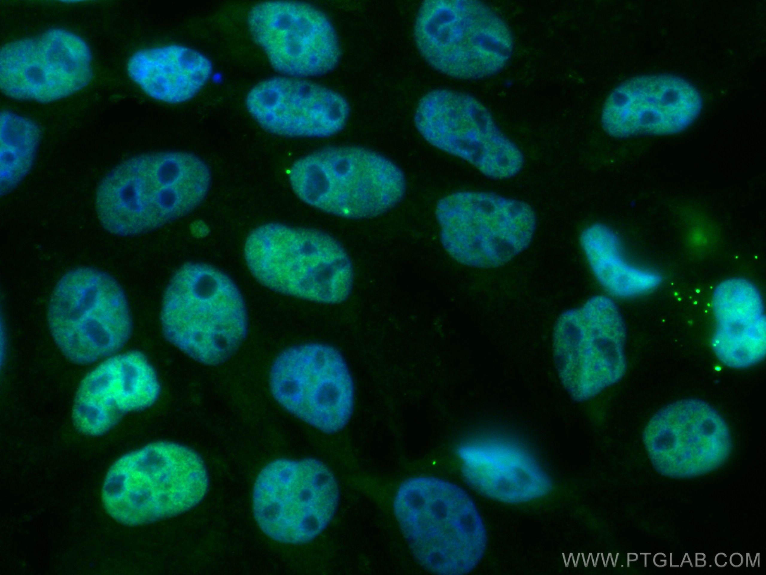Immunofluorescence (IF) / fluorescent staining of A431 cells using CoraLite® Plus 488-conjugated p63 Polyclonal antib (CL488-12143)