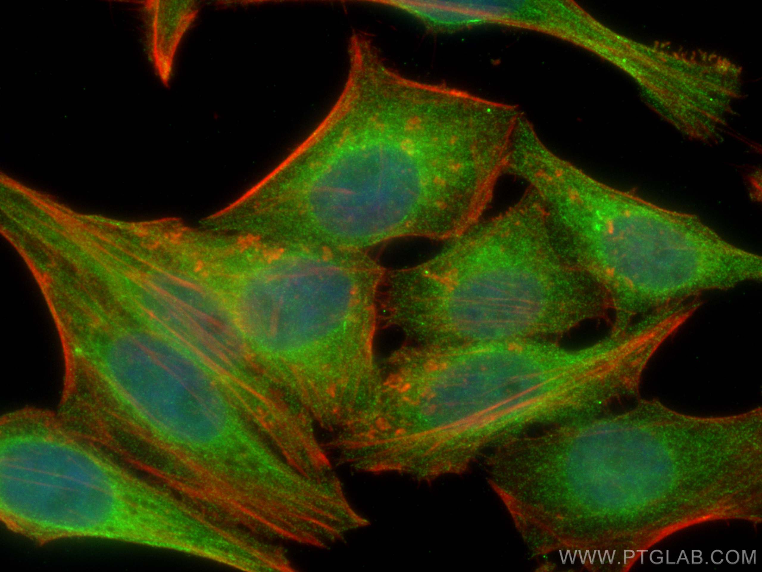 Immunofluorescence (IF) / fluorescent staining of HepG2 cells using NF-κB p65 Monoclonal antibody (66535-1-Ig)