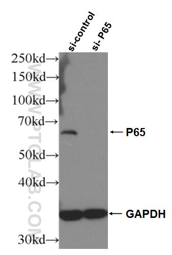 Western Blot (WB) analysis of HEK-293 cells using NF-κB p65 Monoclonal antibody (66535-1-Ig)