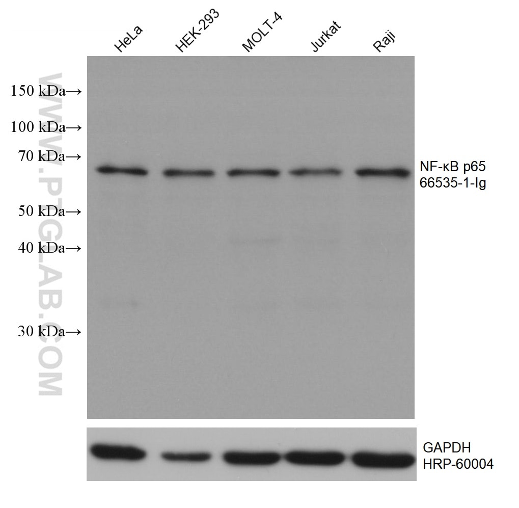 Western Blot (WB) analysis of various lysates using NF-κB p65 Monoclonal antibody (66535-1-Ig)