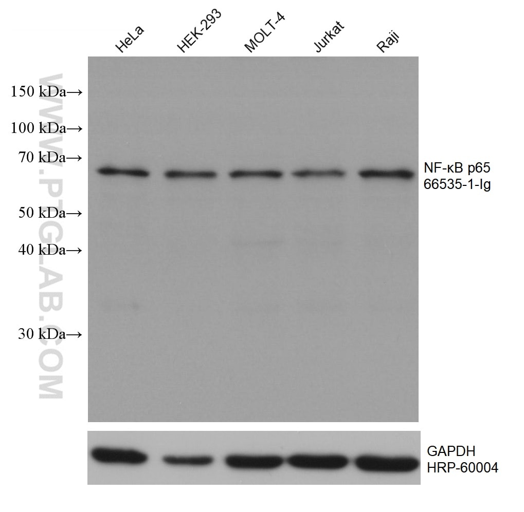 WB analysis using 66535-1-Ig