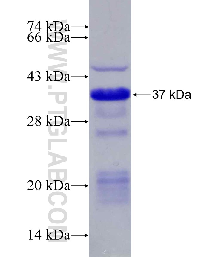 p65; RELA fusion protein Ag21522 SDS-PAGE