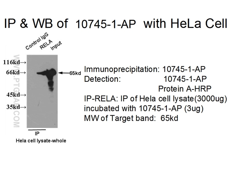 NF-κB p65