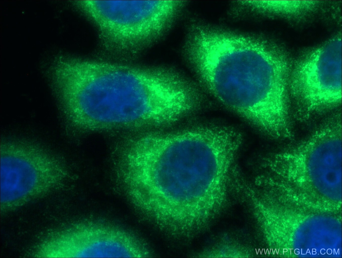 Immunofluorescence (IF) / fluorescent staining of HepG2 cells using NF-κB p65 Polyclonal antibody (10745-1-AP)