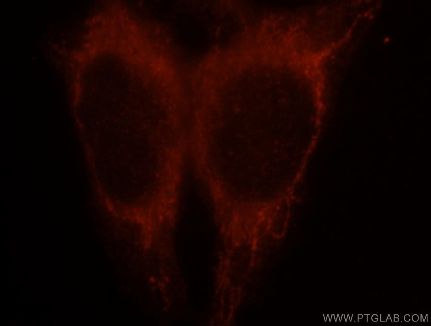 NF-κB p65 Polyclonal antibody