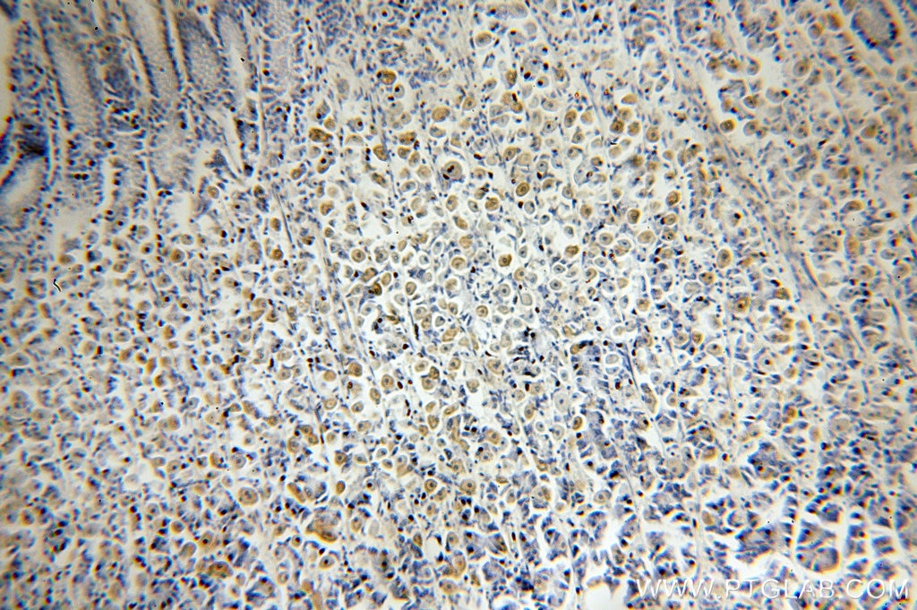 Immunohistochemistry (IHC) staining of human stomach tissue using NF-κB p65 Polyclonal antibody (10745-1-AP)