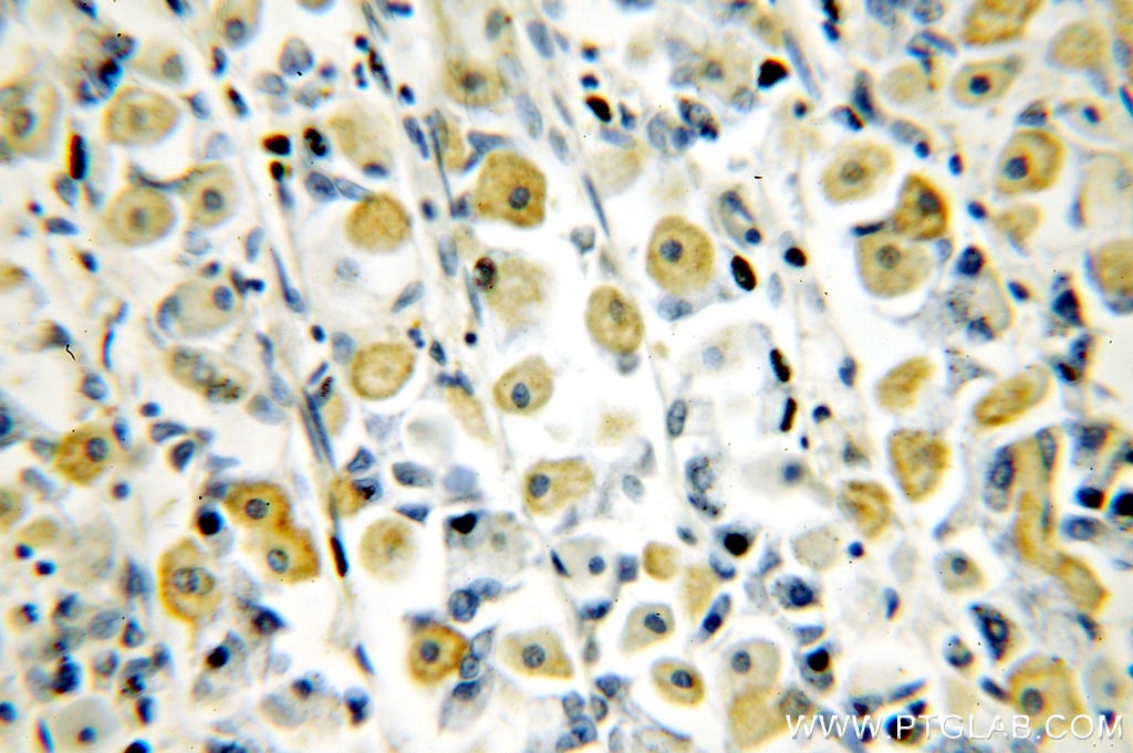 Immunohistochemistry (IHC) staining of human stomach tissue using NF-κB p65 Polyclonal antibody (10745-1-AP)