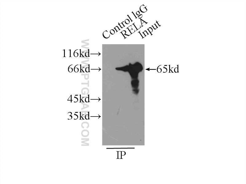 Immunoprecipitation (IP) experiment of HeLa cells using NF-κB p65 Polyclonal antibody (10745-1-AP)