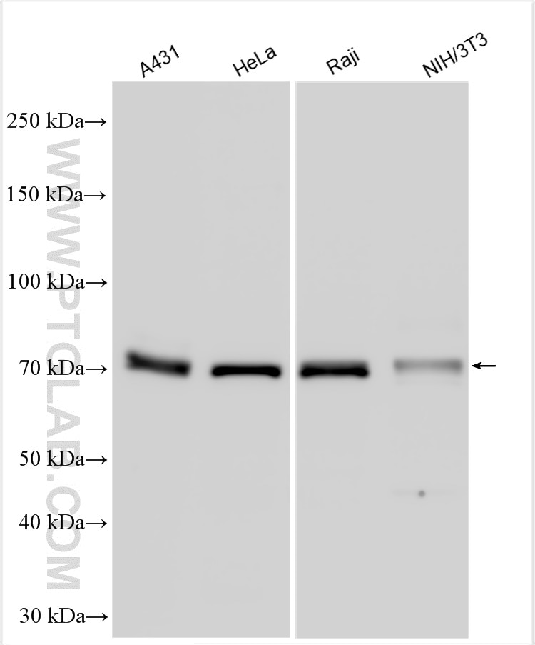 Western Blot (WB) analysis of various lysates using NF-κB p65 Polyclonal antibody (10745-1-AP)