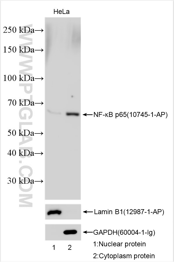 Western Blot (WB) analysis of various lysates using NF-κB p65 Polyclonal antibody (10745-1-AP)