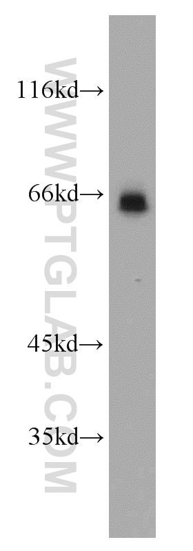 Western Blot (WB) analysis of MCF-7 cells using NF-κB p65 Polyclonal antibody (10745-1-AP)