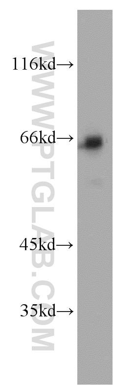 Western Blot (WB) analysis of K-562 cells using NF-κB p65 Polyclonal antibody (10745-1-AP)