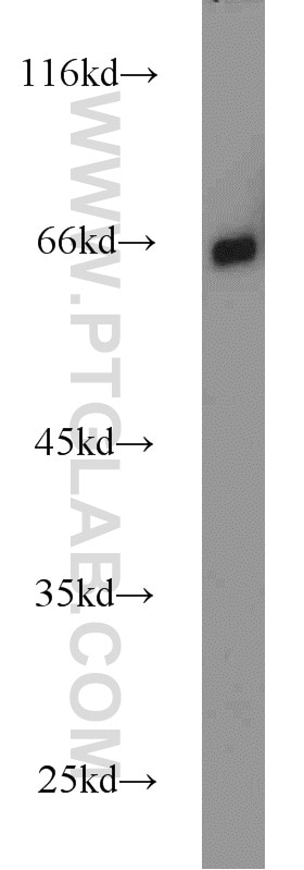 Western Blot (WB) analysis of Jurkat cells using NF-κB p65 Polyclonal antibody (10745-1-AP)