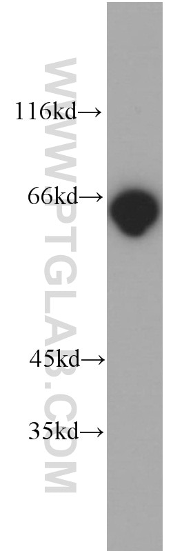 NF-κB p65 Polyclonal antibody