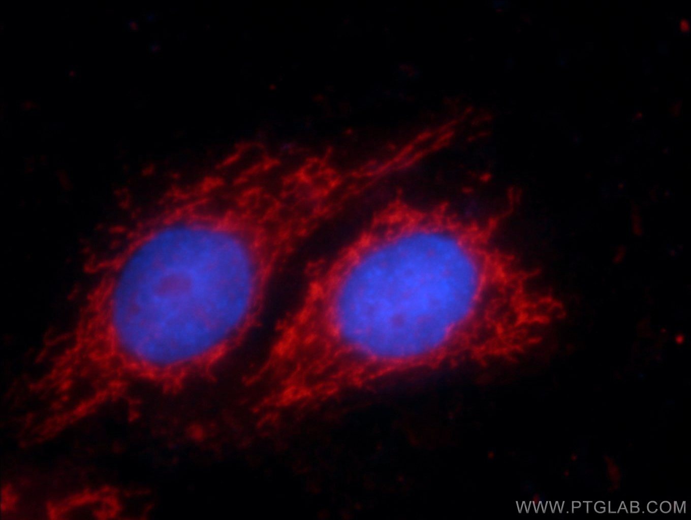 Immunofluorescence (IF) / fluorescent staining of HepG2 cells using p70(S6K) Polyclonal antibody (14485-1-AP)