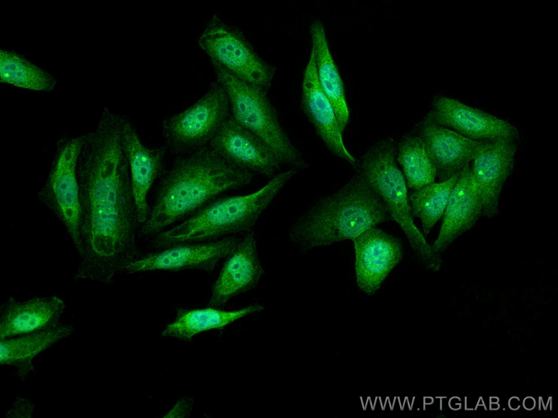 Immunofluorescence (IF) / fluorescent staining of HepG2 cells using p70(S6K) Polyclonal antibody (14485-1-AP)