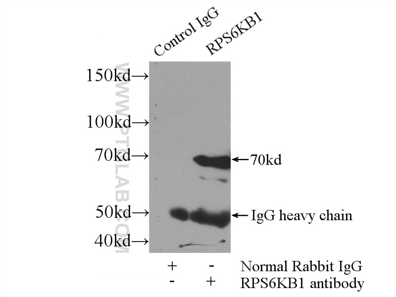 Immunoprecipitation (IP) experiment of HeLa cells using p70(S6K) Polyclonal antibody (14485-1-AP)